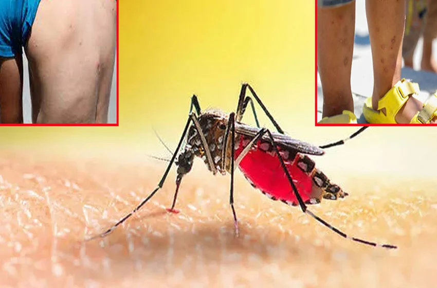 İstanbul'da Aedes Alarmı! Sivrisinekler Bulaştırıyor 