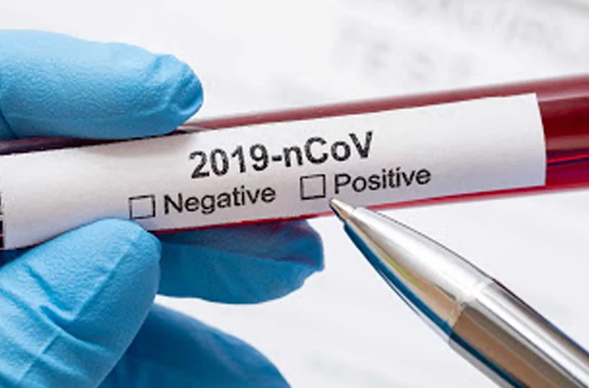 9 Kasım Koronavirüs Tablosu
